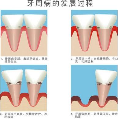 ׵ıF(xin)